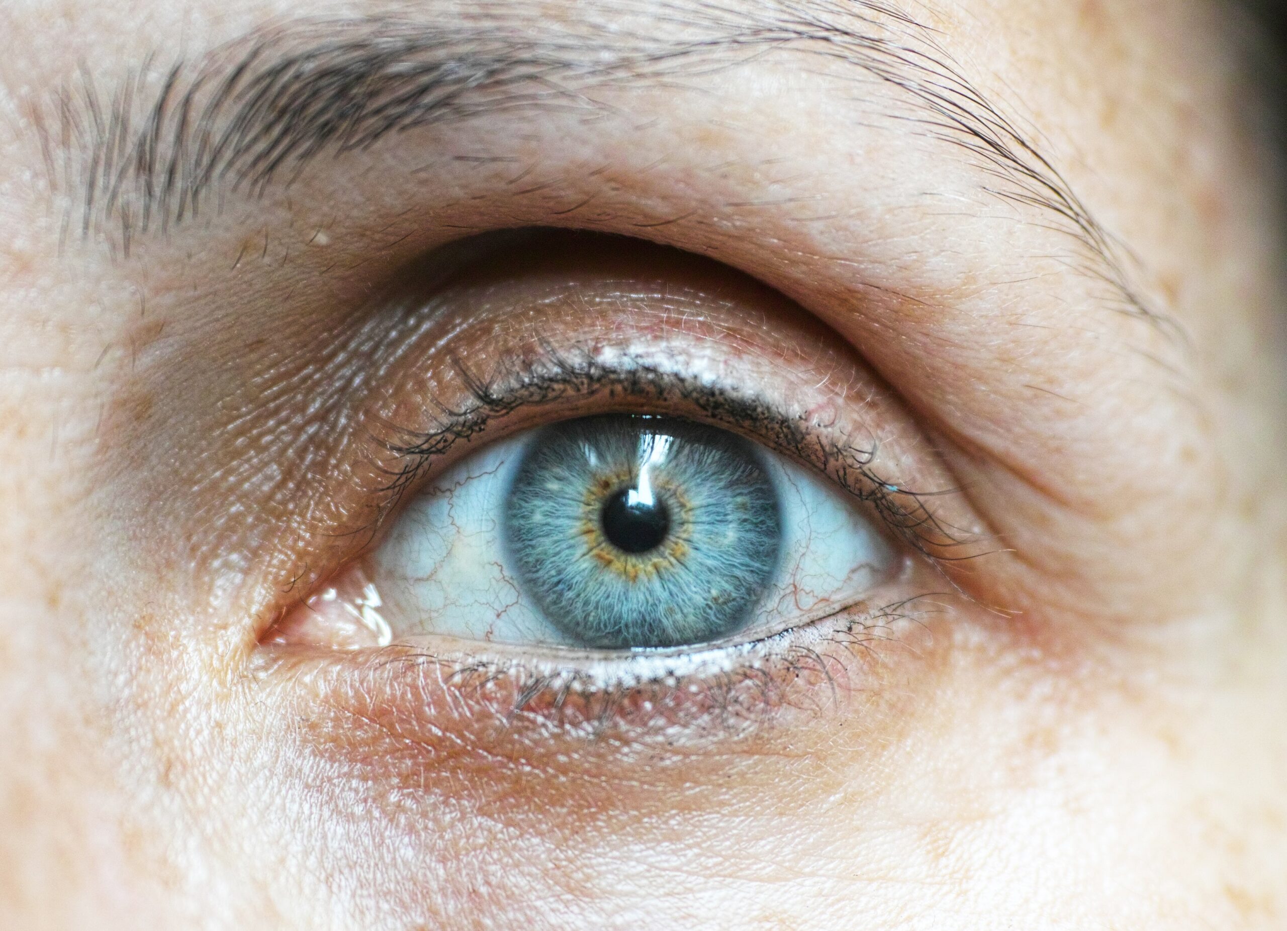Síndrome do olho seco – um desses sintomas pode indicar que você tenha